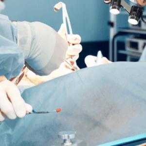 Reconstructive Surgery