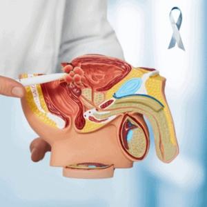 Urological Cancer Surgery